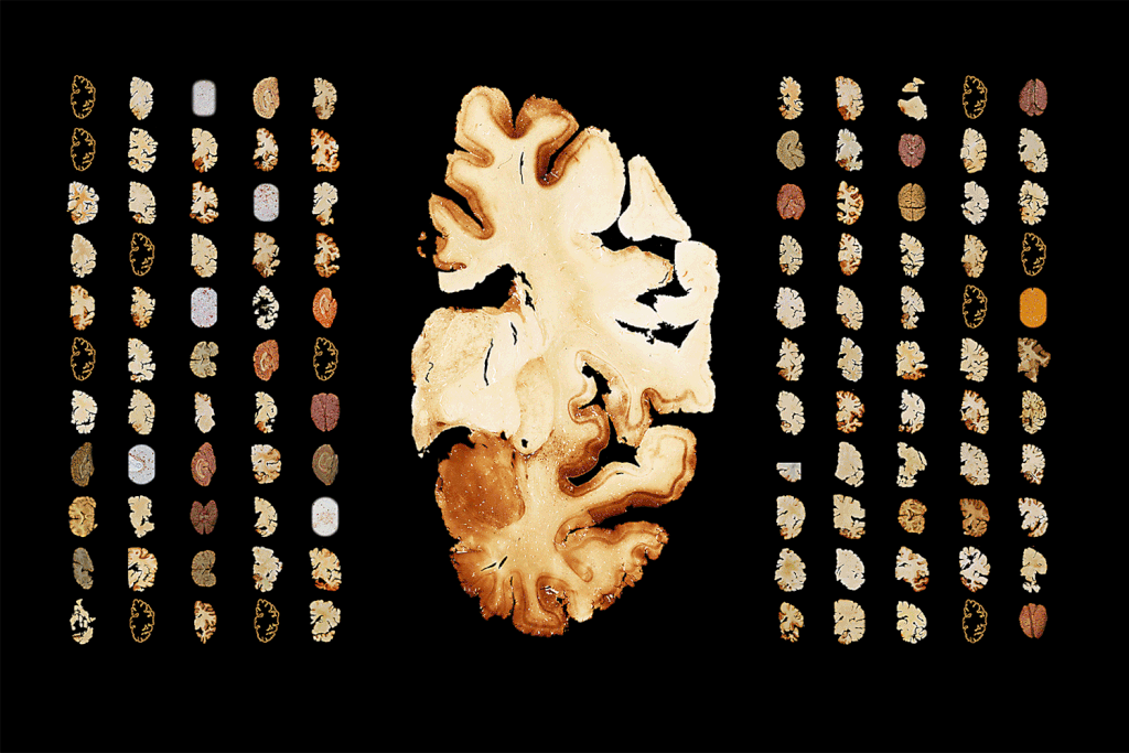 Concussions by Position Video Infographic